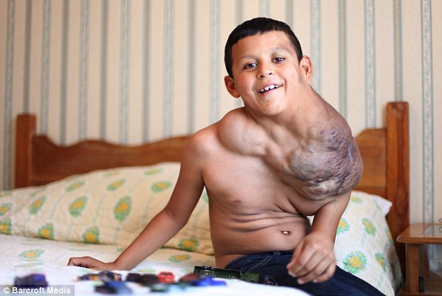 Boy Has Football-Sized Tumor Removed From His Neck ...