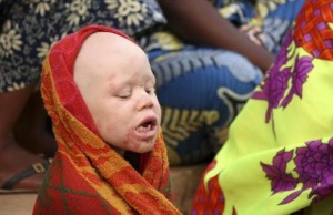 An albino child sits outside the courtroom in Ruyigi