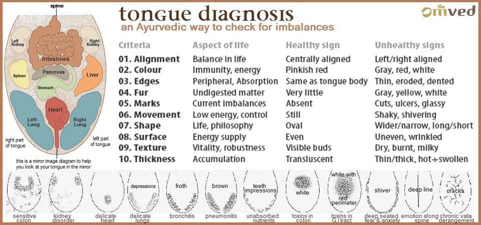 Ayurvedic Tongue Diagnosis Chart