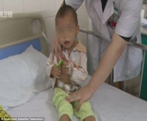 2BAC60C000000578-3211356-Pain_A_toddler_from_southeast_China_has_been_hospitalised_after_-a-4_1440590238572