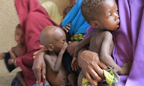 children-malnourished