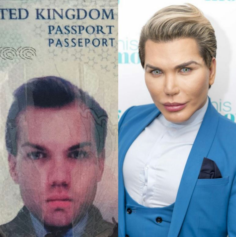 Before & After Human Ken Doll who spent £400k on plastic