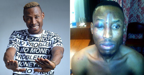 Image result for Singer, Mr 2Kay robbed at gunpoint in hotel room