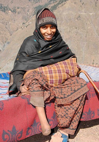 Smiles ... Salima Was Born With Only One Leg & Is Not Ashamed To Flaunt It
