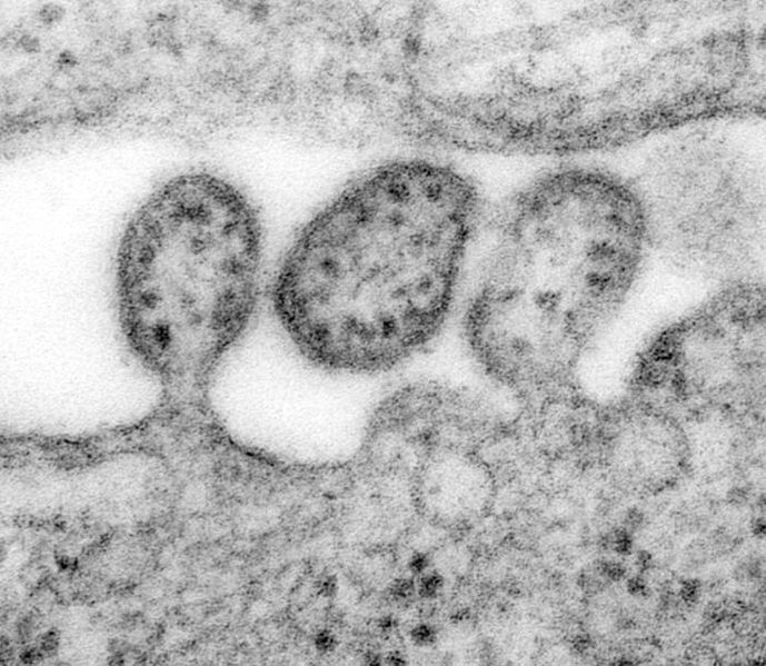 Lassa fever virus as viewed under a microscope