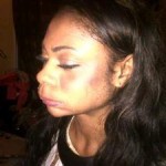 PHOTO OF KAREN IGHO'S BRUISED FACE FOLLOWING THE SLAP BY A SECURITY GUARD