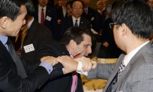 Handout photo of U.S. Ambassador to South Korea Lippert leaving after he was slashed in the face by a member of a pro-Korean unification group at a public forum in central Seoul