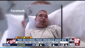 Florida-man-hospitalized-after-attempt-to-kiss-venomous-snake