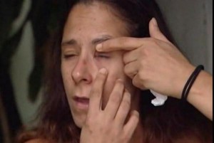 Florida-woman-accidentally-super-glued-her-eye-shut
