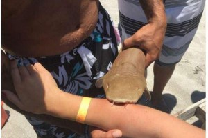 Florida-woman-taken-to-hospital-with-shark-attached-to-arm