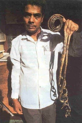Man With World's Longest Fingernails Cut Them After 66 years (Photo) -  Information Nigeria