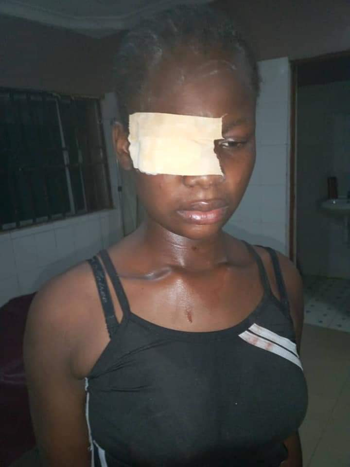 17-year-old almost blinded for refusing sexual advances from a man