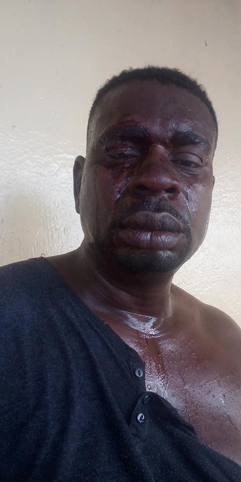 [Photos]: Veteran singer Baba Fryo beaten by unknown soldiers