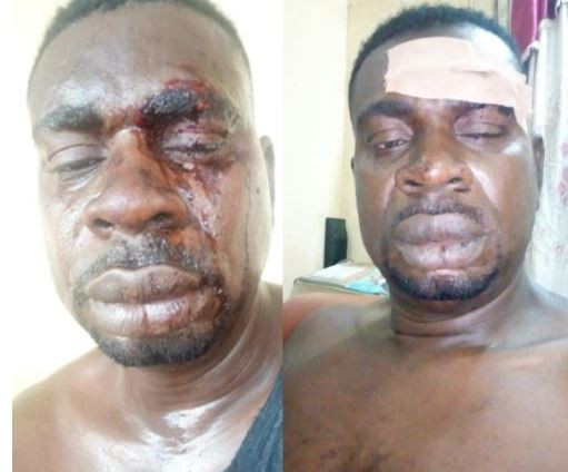 [Photos]: Veteran singer Baba Fryo beaten by unknown soldiers