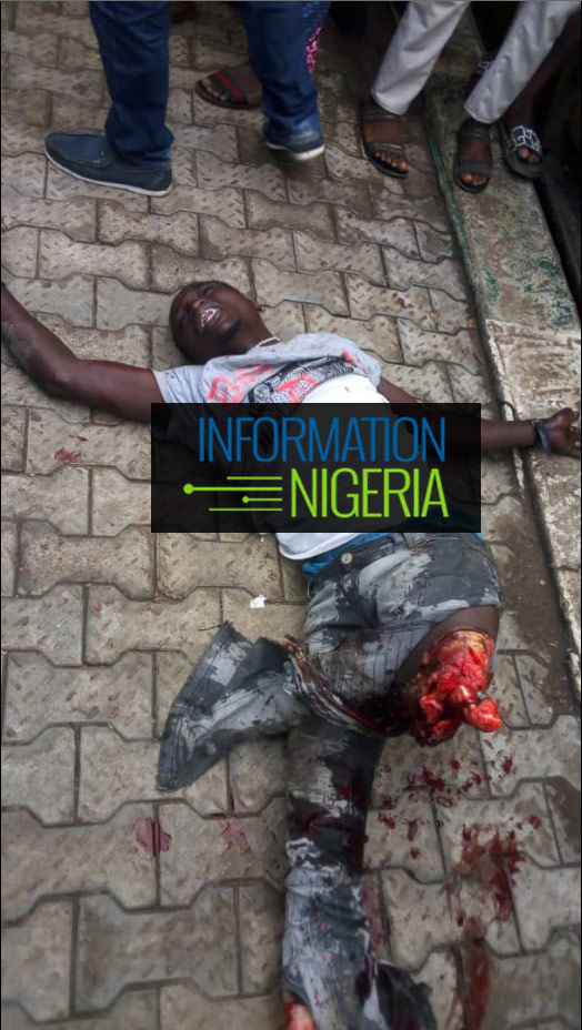 Graphic!!! Man's legs sliced off after he jumped off a moving train at Ikeja