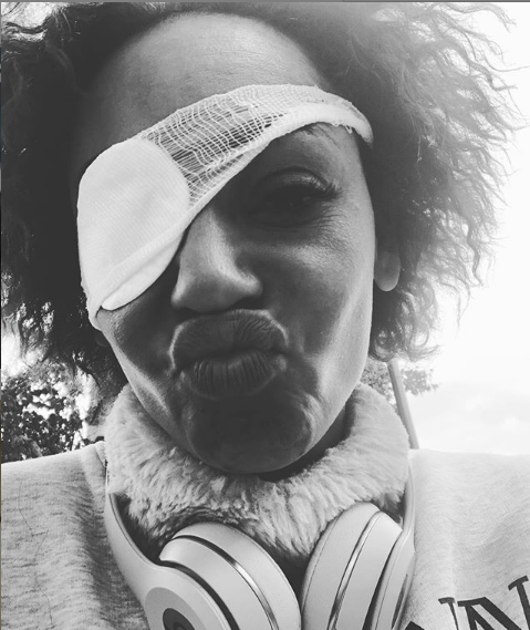 Mel B releases statement, confirms she did go blind in one eye