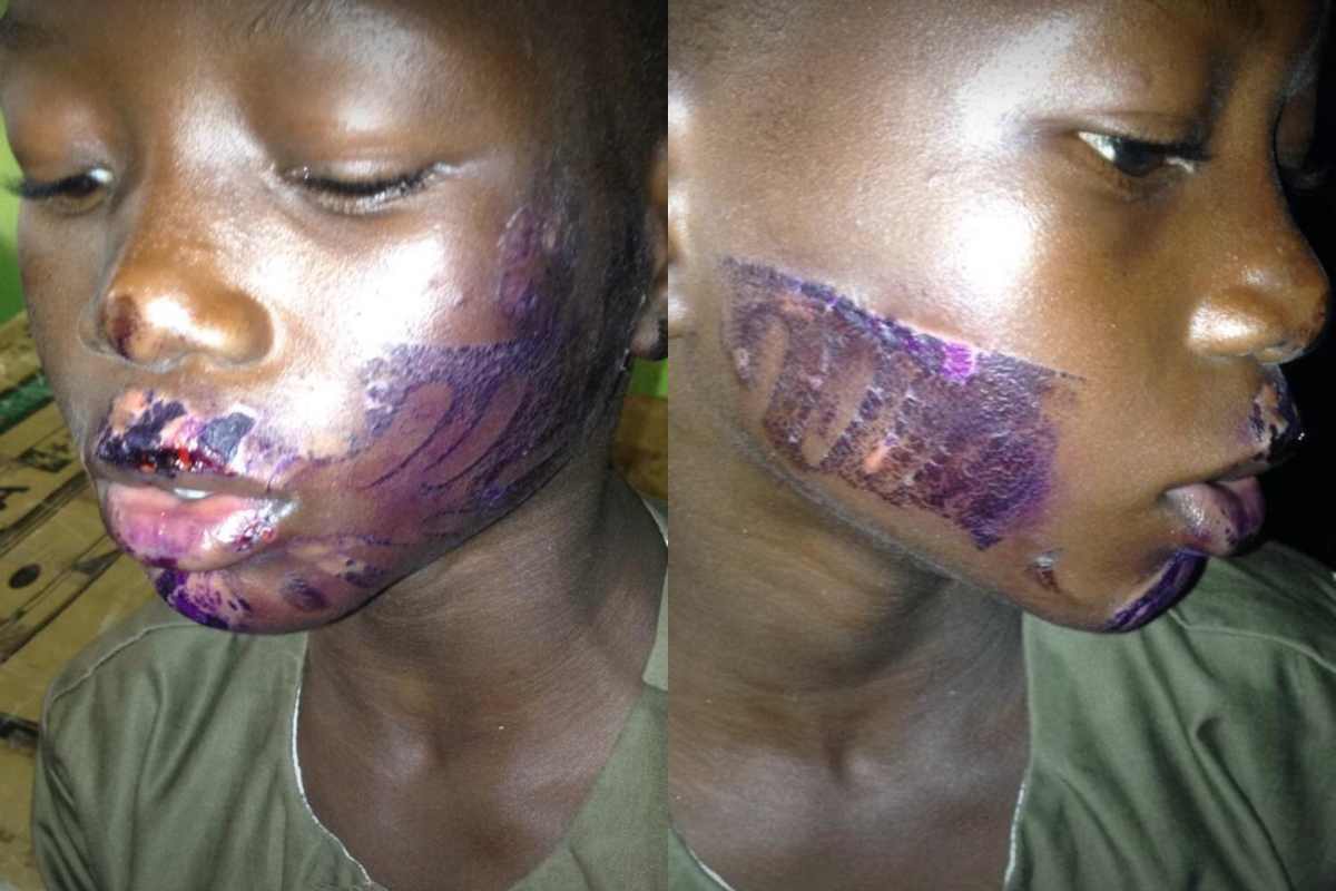 [Photos]: See a stepmother disfigured her stepson in Lagos