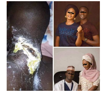 [Photos]: Wife allegedly injected her husband with rat poison