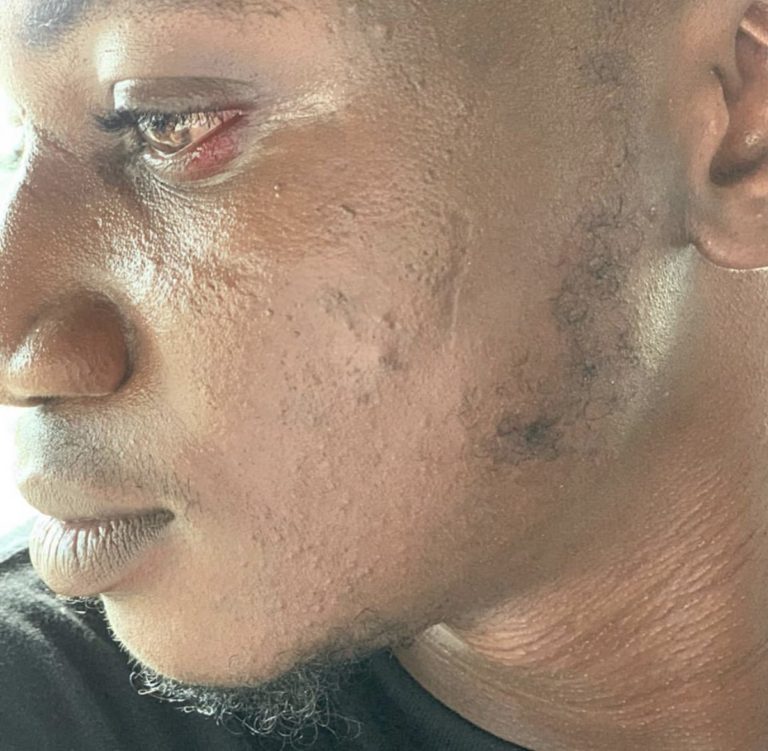 Pamilerin speaks on next line of action after the slap episode with Peruzzi