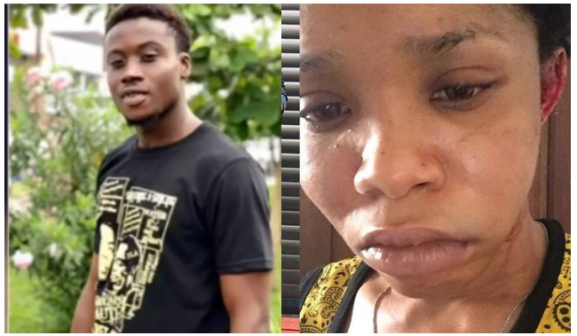 [Photos]: Nigerian singer allegedly beats girlfriend into a pulp for coming home late