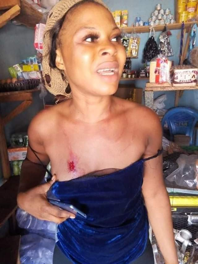 [Photos]: Woman brutally beaten by security guards in Enugu
