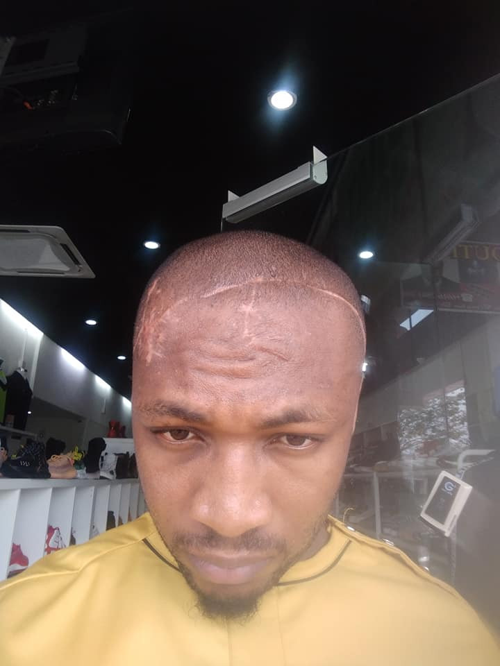 Malaysian-Based Nigeria Narrates How He Was Almost Murdered By His Own Brother