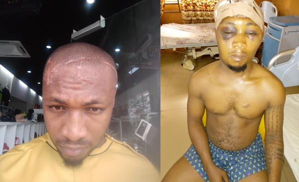 Malaysian-Based Nigeria Narrates How He Was Almost Murdered By His Own Brother