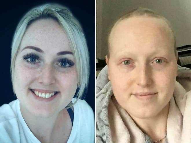 Woman Undergoes Cancer Treatment For Cancer She Does Not Have