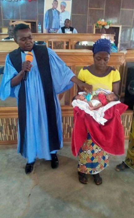 [Photos]: Woman Gives Birth To Conjoined Twins In Benue State