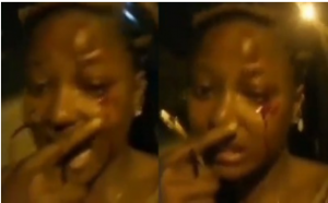 The black eyed lady after allegedly beaten by police