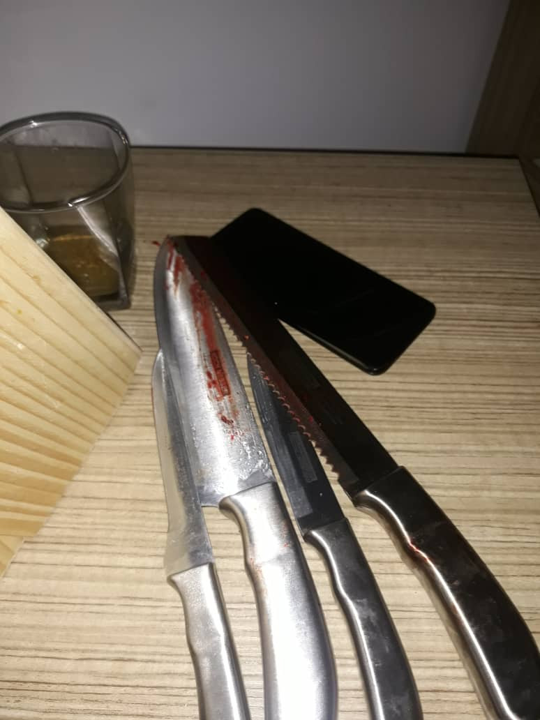 Photo of the bloody knives from the crime scene